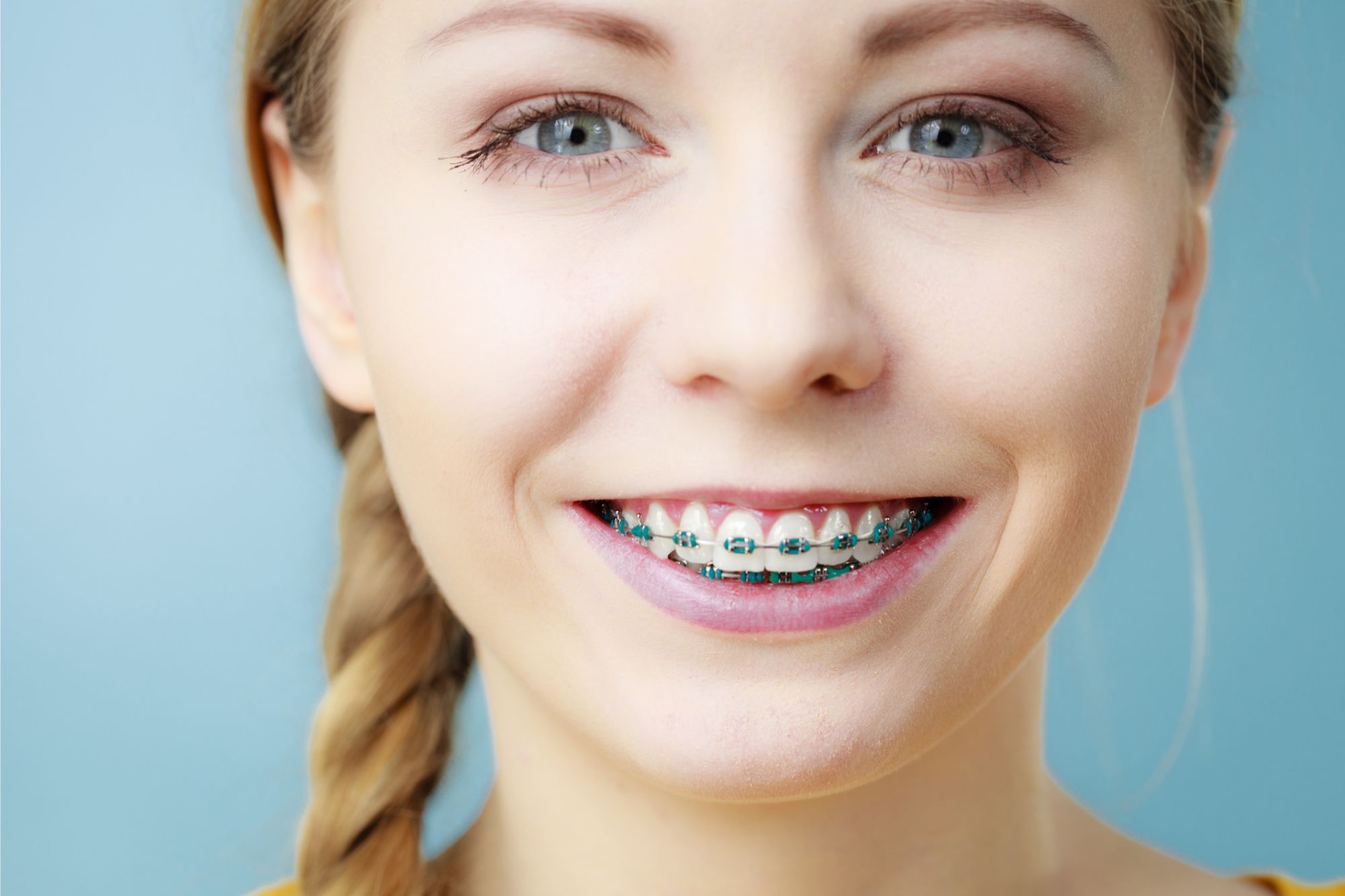 braces treatment Latham NY
