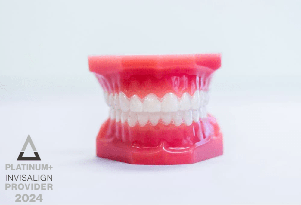 invisalign aligners on plastic model